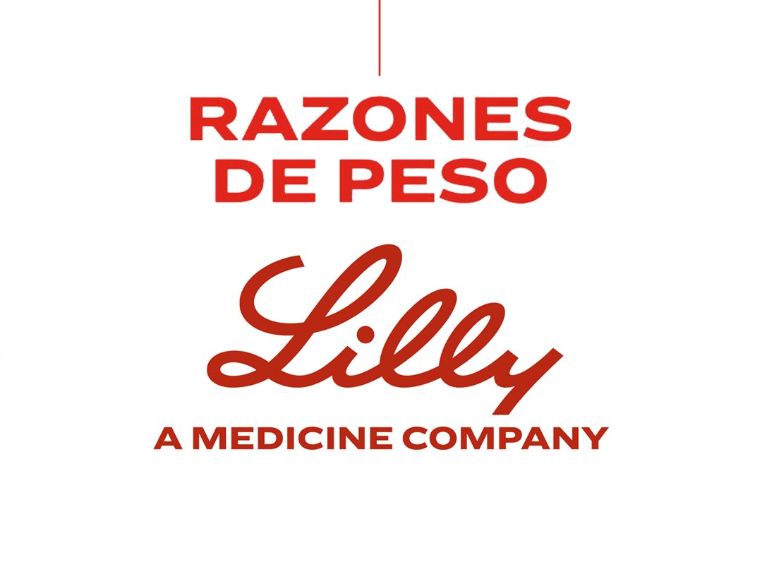 Razones de Peso